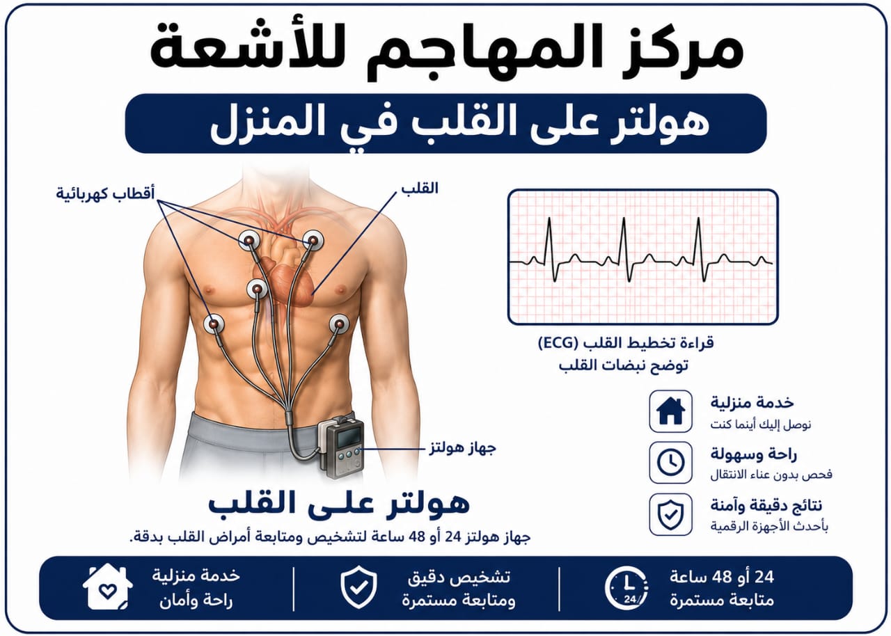 هولتر على القلب